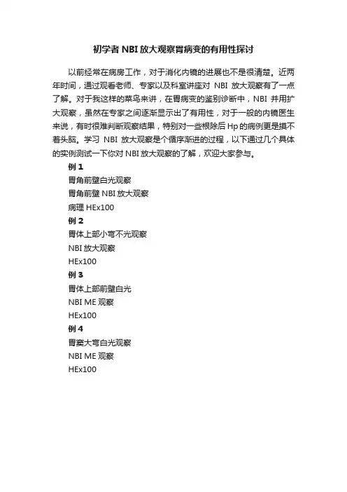 初学者NBI放大观察胃病变的有用性探讨