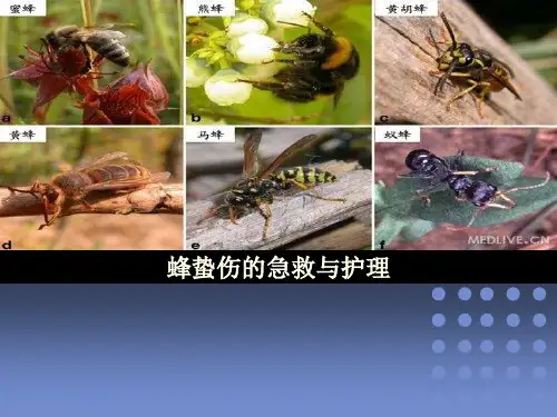 蜂蛰伤的急救与护理ppt课件