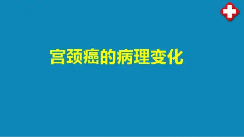生殖系统和乳腺疾病(病理学课件)