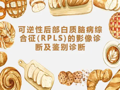 可逆性后部白质脑病综合征(RPLS)的影像诊断及鉴别诊断