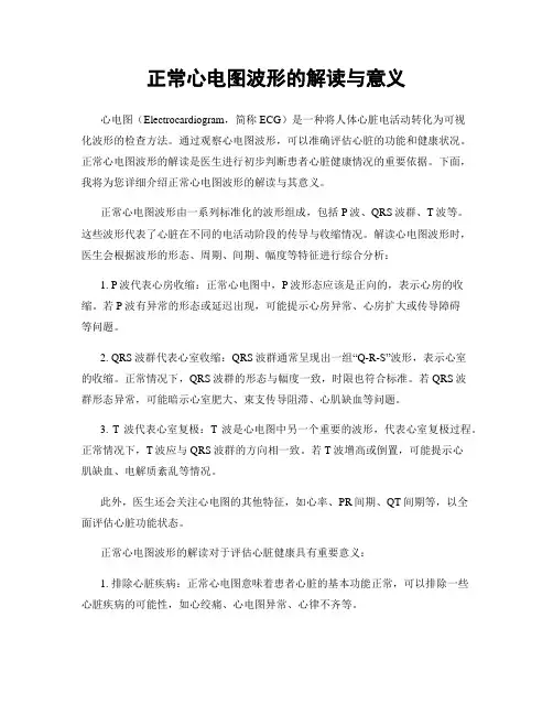正常心电图波形的解读与意义