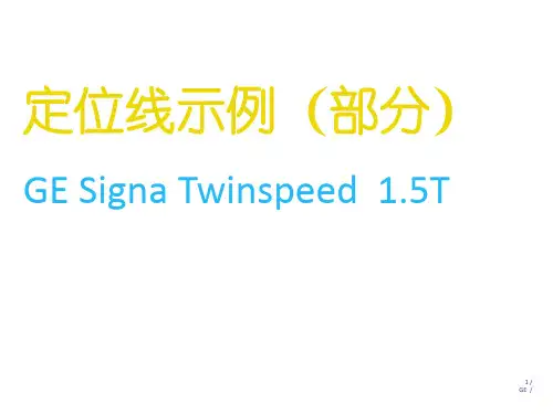 GE 1.5T磁共振操作指南-定位线示例(神经系统)