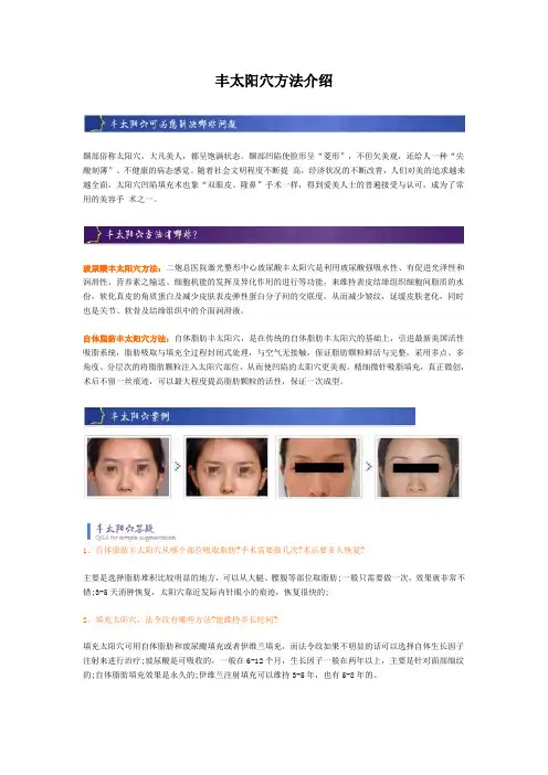 丰太阳穴方法有哪些