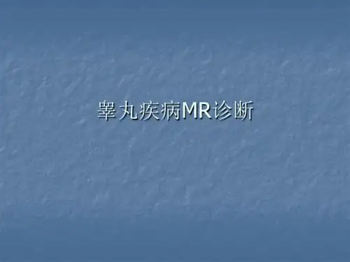 睾丸MR诊断ppt课件