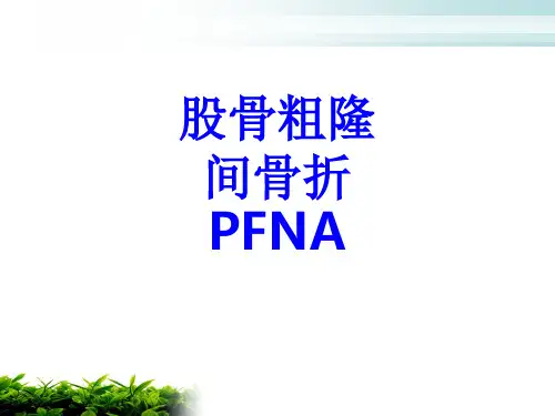 股骨粗隆间骨折PFNAPPT培训课件