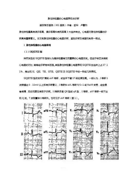 急性肺栓塞的心电图表现与诊断