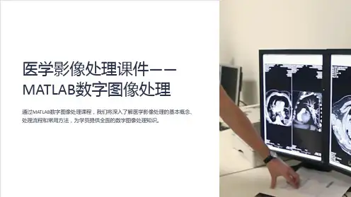 《医学影像处理课件——MATLAB数字图像处理》