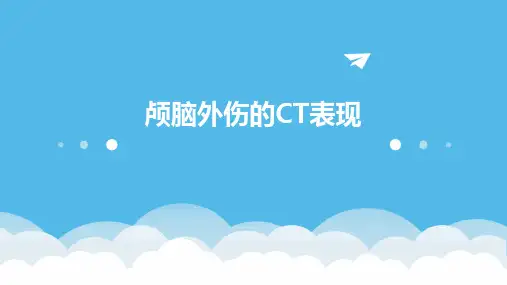 《颅脑外伤的CT表现》课件