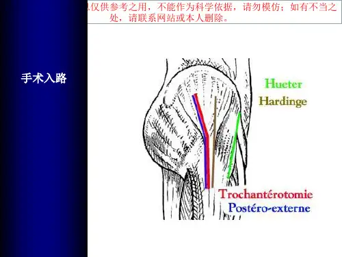 全髋关节置换手术入路培训课件