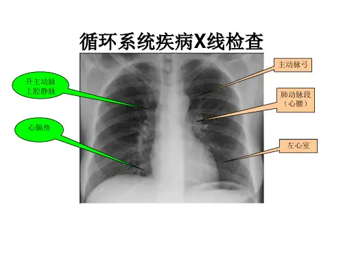 循环系统疾病X线检查