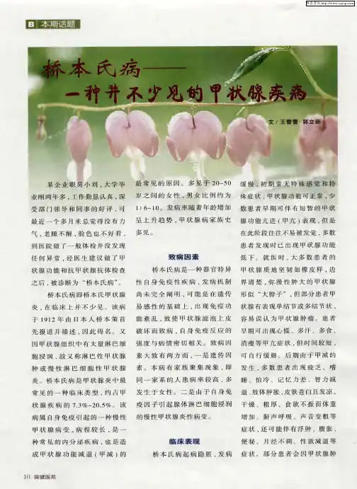 桥本氏病——一种并不少见的甲状腺疾病