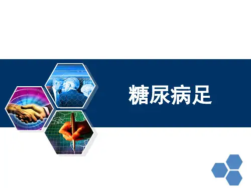 糖尿病足疾病机理、临床表现、检查方法、预防措施及治疗措施