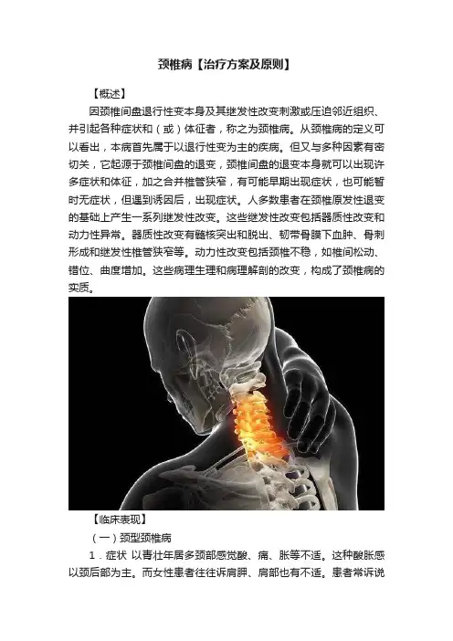 颈椎病【治疗方案及原则】