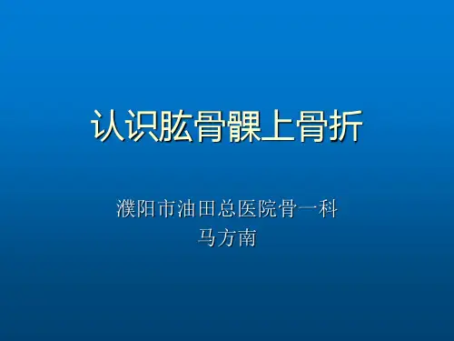 认识肱骨髁上骨折ppt课件