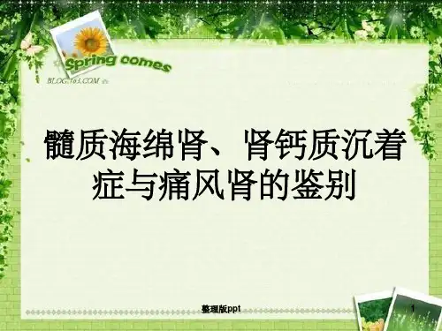 海绵肾、肾钙质沉着症与痛风肾的超声鉴别