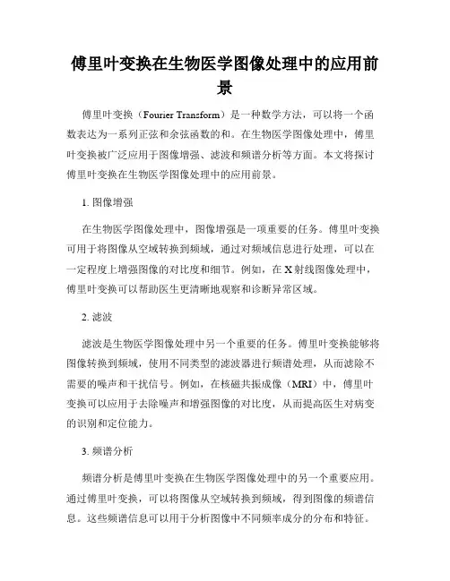 傅里叶变换在生物医学图像处理中的应用前景