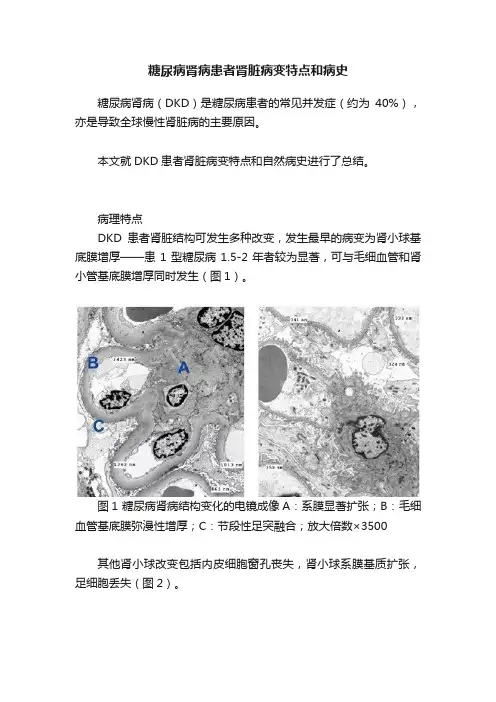 糖尿病肾病患者肾脏病变特点和病史