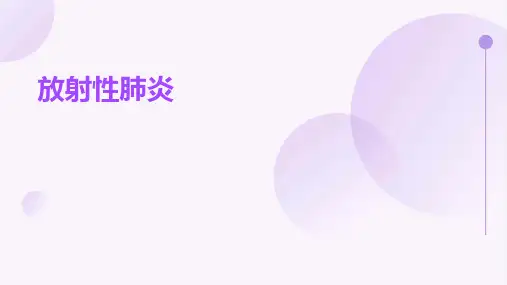 放射性肺炎