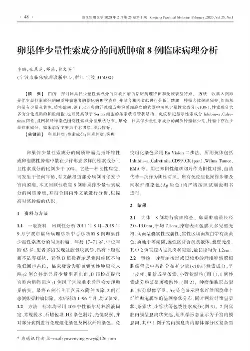 卵巢伴少量性索成分的间质肿瘤8例临床病理分析