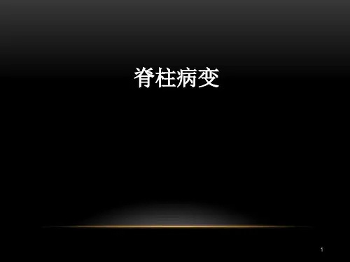 脊柱病变 ppt课件