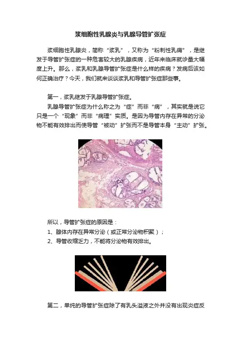 浆细胞性乳腺炎与乳腺导管扩张症