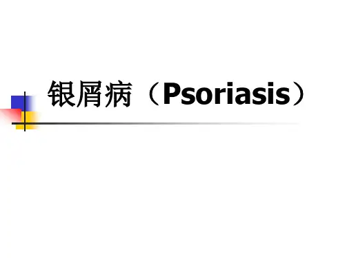 银屑病(Psoriasis)精品医学课件