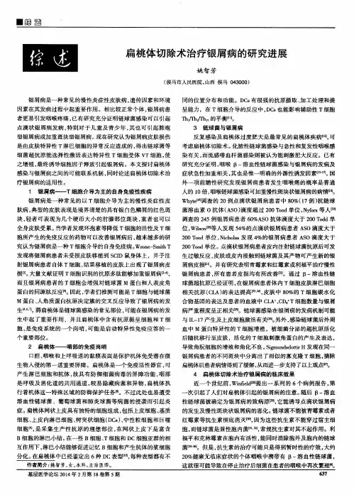 扁桃体切除术治疗银屑病的研究进展