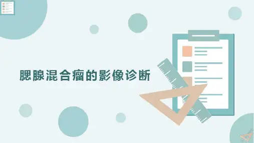 腮腺混合瘤的影像诊断