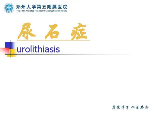 尿石症-精品医学课件