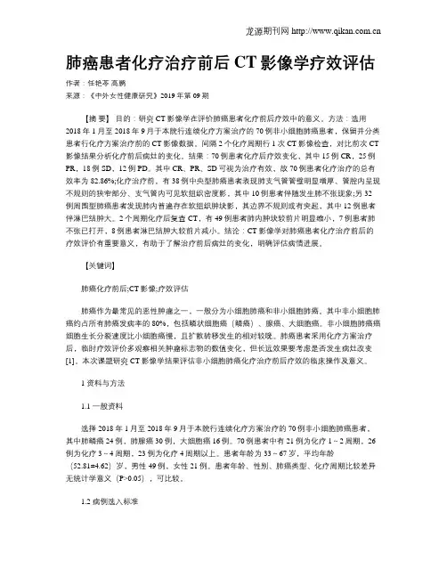 肺癌患者化疗治疗前后CT影像学疗效评估