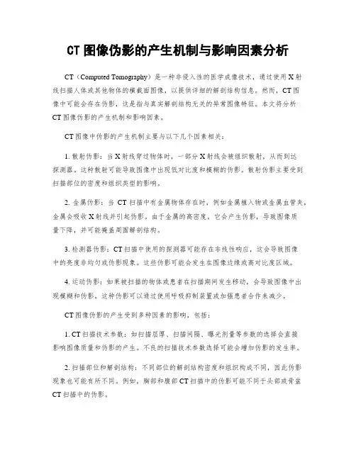 CT图像伪影的产生机制与影响因素分析