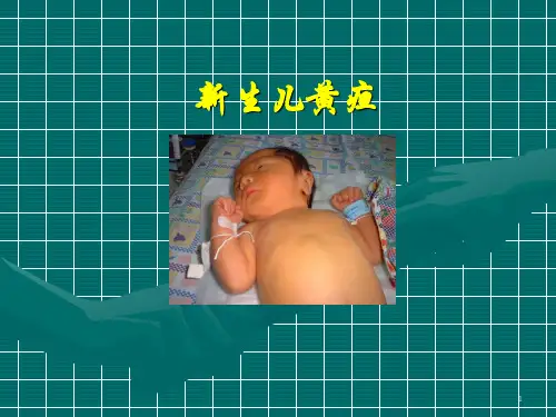新生儿病理性黄疸PPT课件