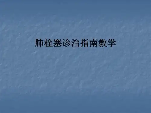 肺栓塞诊治指南ppt课件
