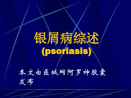 银屑病综述分析