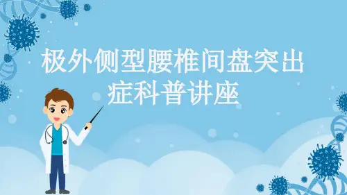 极外侧型腰椎间盘突出症科普讲座