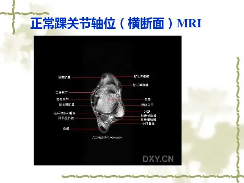 踝关节正常MRI解剖图谱ppt