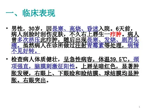 局解PBL课件