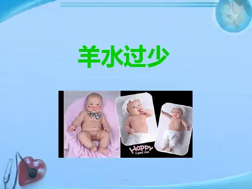 羊水过少  ppt课件