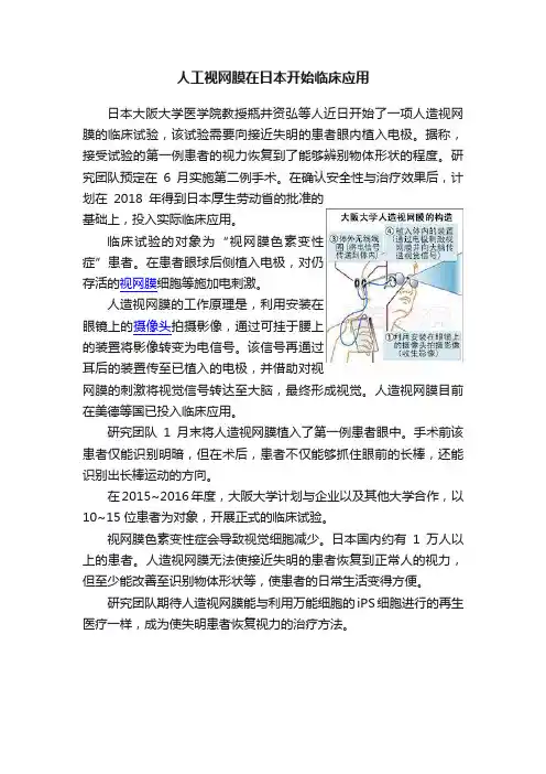 人工视网膜在日本开始临床应用