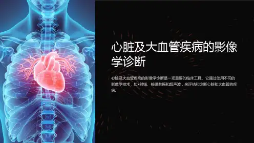 心脏及大血管疾病的影像学诊断