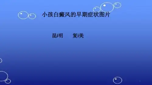 (参考课件)小孩白癜风的早期症状图片