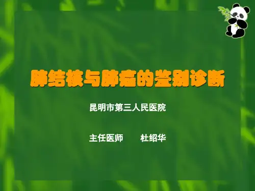 肺结核与肺癌的鉴别诊断