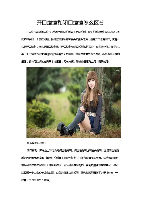 开口痘痘和闭口痘痘怎么区分