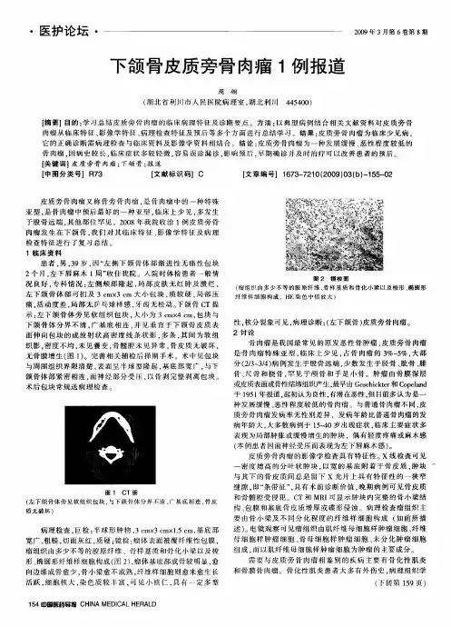 下颌骨皮质旁骨肉瘤1例报道