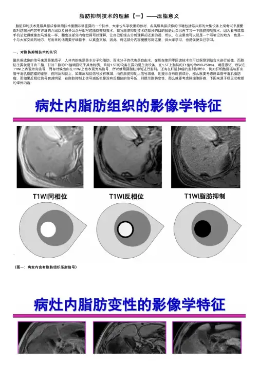 脂肪抑制技术的理解【一】——压脂意义