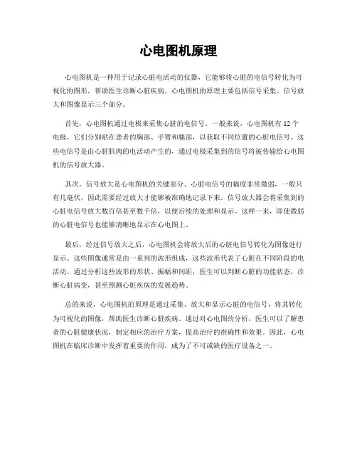 心电图机原理
