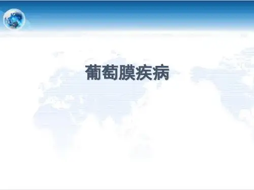 眼科学PPT课件 葡萄膜病