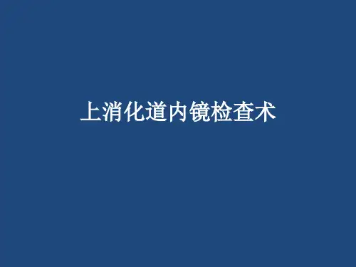 上消化道内镜检查术