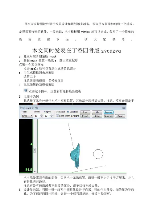 mimics手术导板制作,简单易行