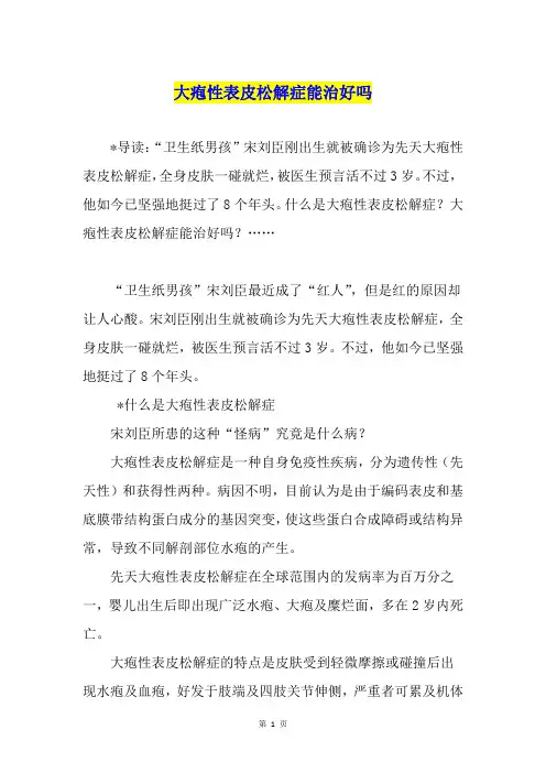 大疱性表皮松解症能治好吗